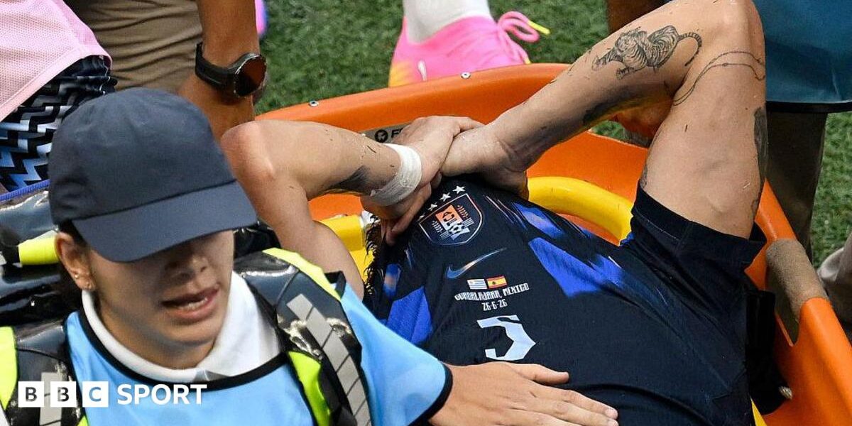 Ugarte has ‘most serious injury footballer can face’